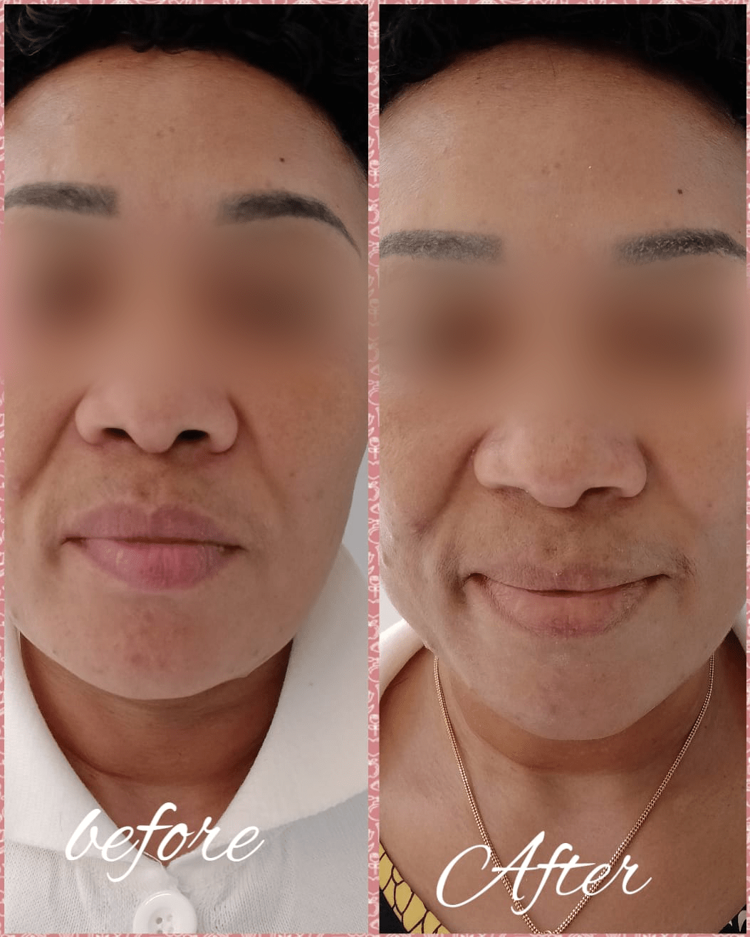 Obaji Red Carpet Facial