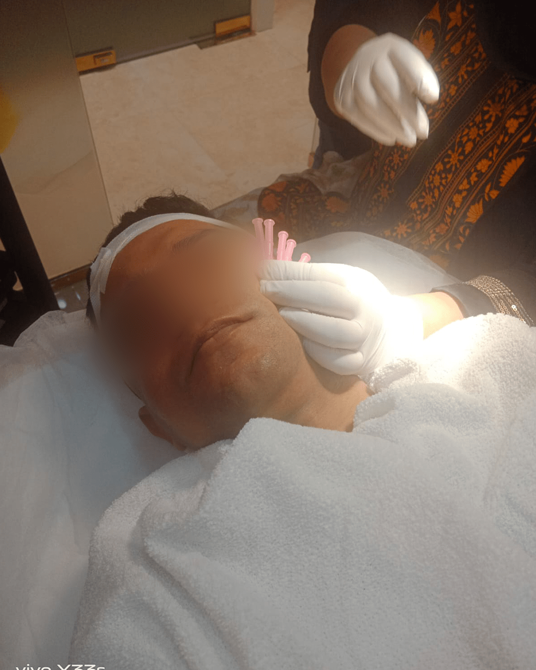 PDO Thread Treatment